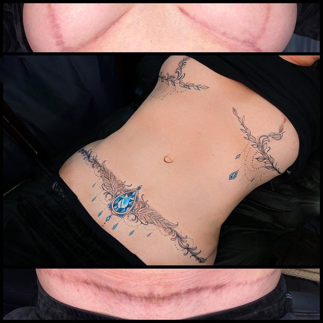 Tatuaje en la cicatriz de Caesarev