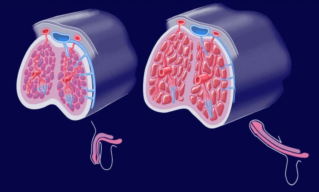 Anatomía de burbujas semenina