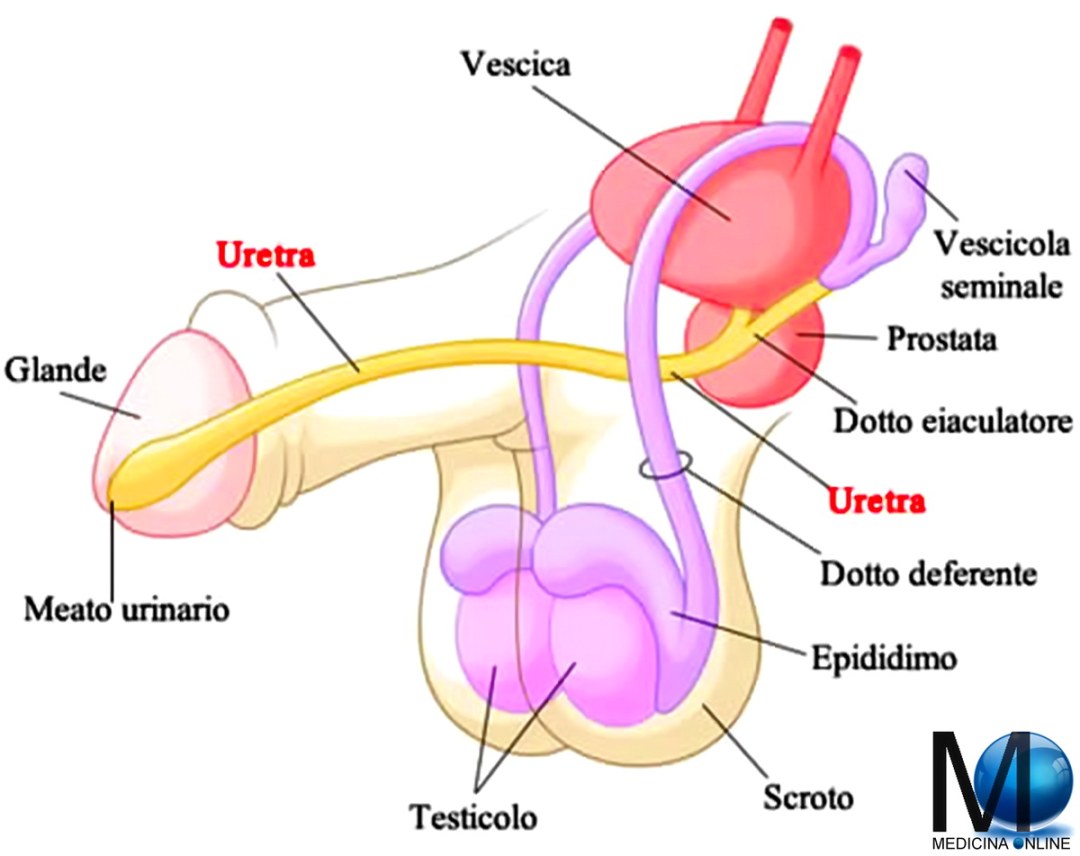 Termoterapia con microondas transuretral