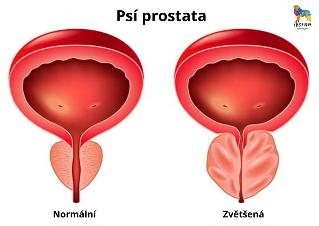 Prevención de la prostatitis en hombres
