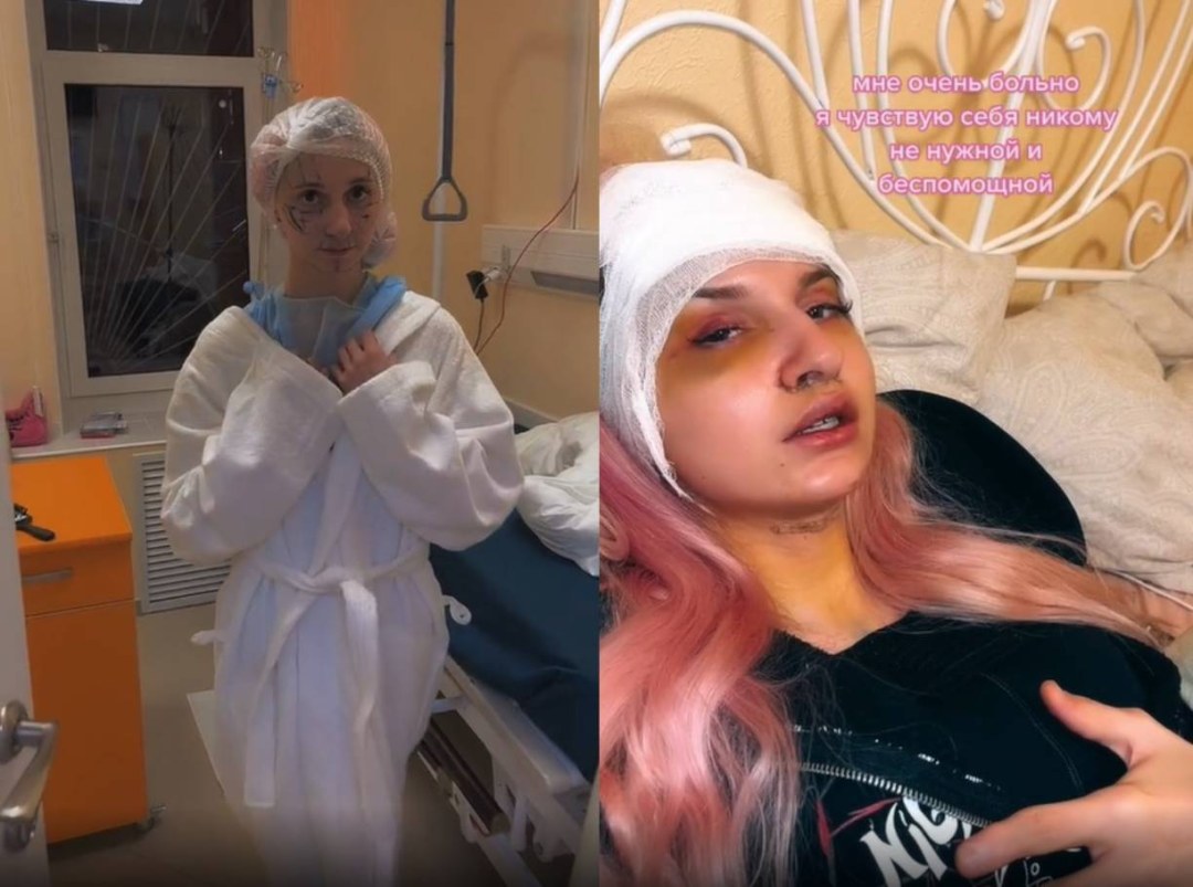 Dasha Koreyka después de la cirugía