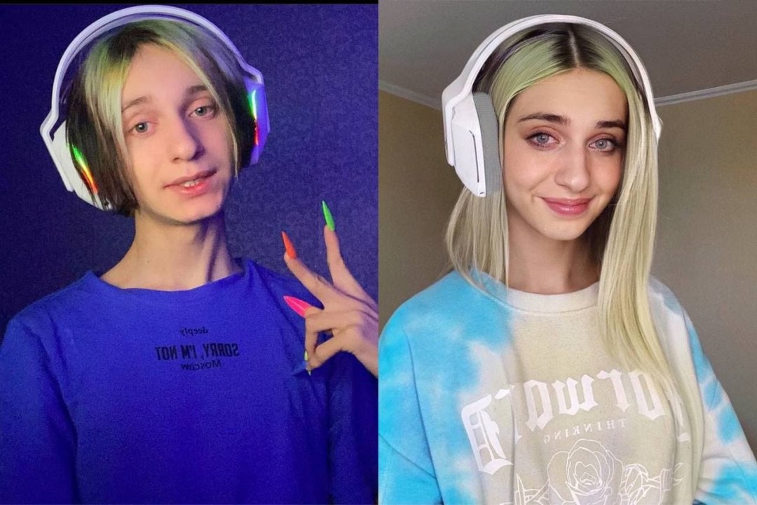 Dasha Koreyka antes y después de la cirugía