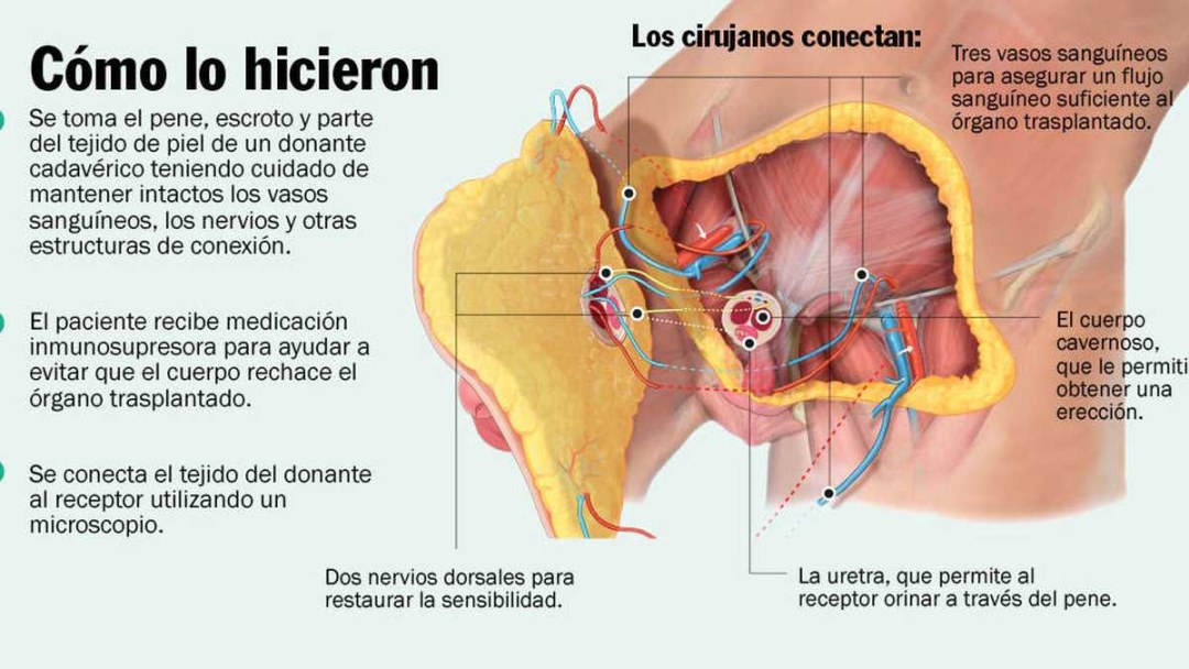 La estructura de los vasos del cuello y la cabeza en la espalda