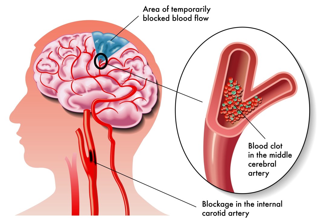 Red neuronal superior