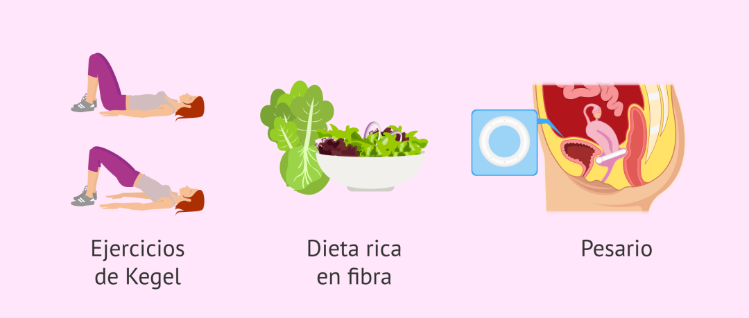 El predominio del vago