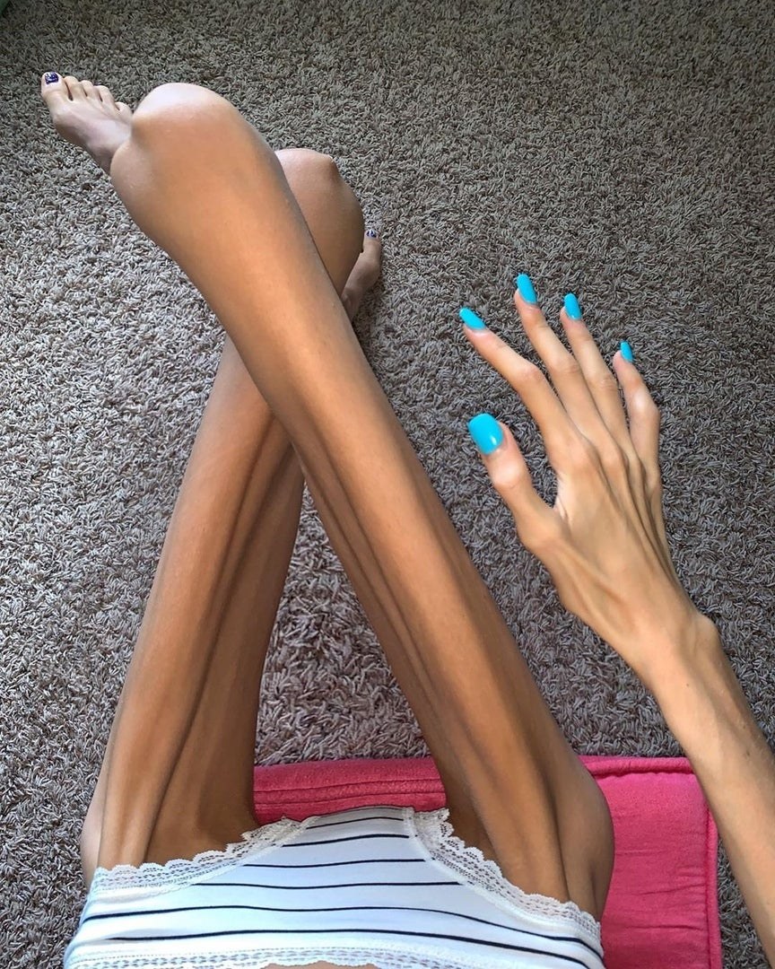 Anorexia flexible y desnuda