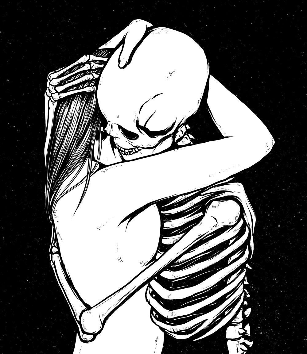 Anorexia nerviosa atípica