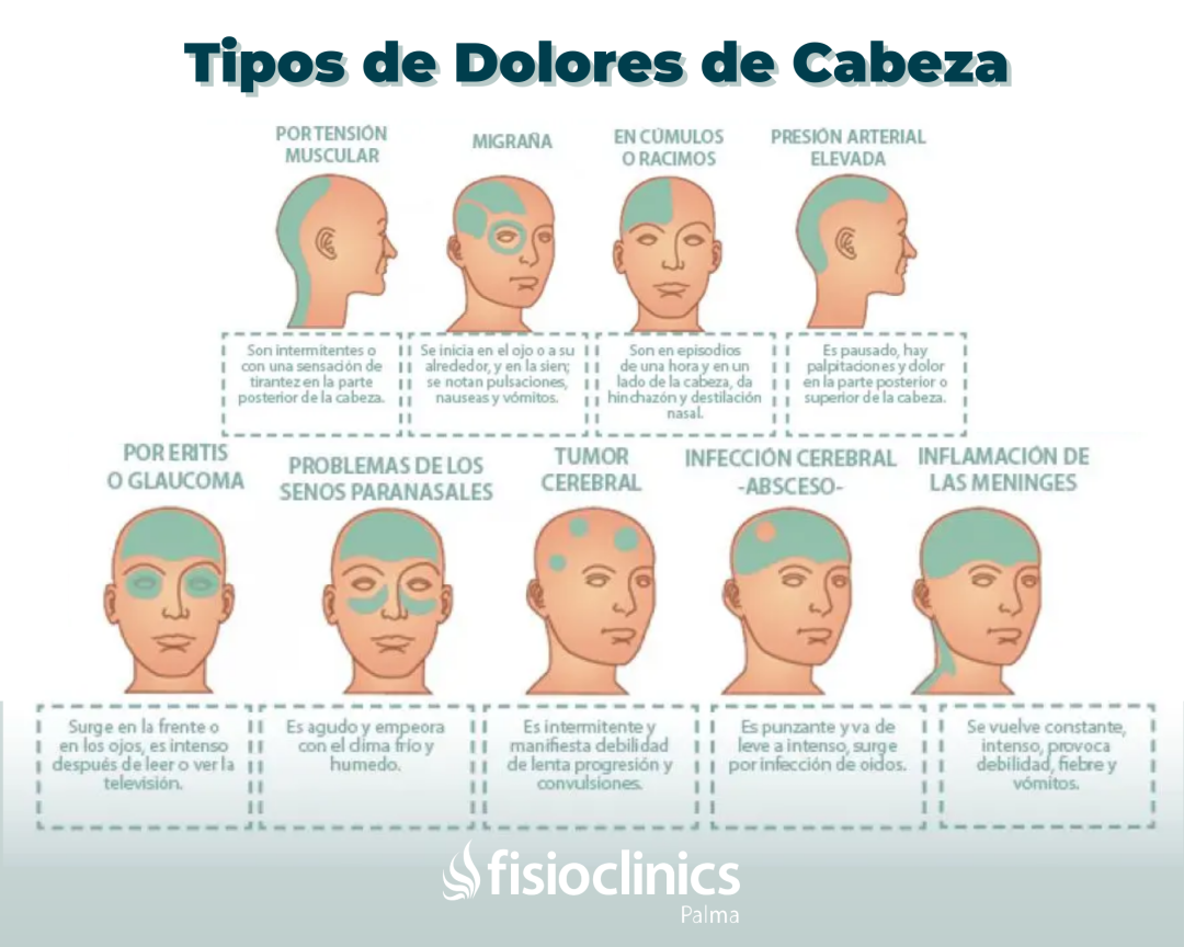 La perspectiva de la referencia de la cabeza