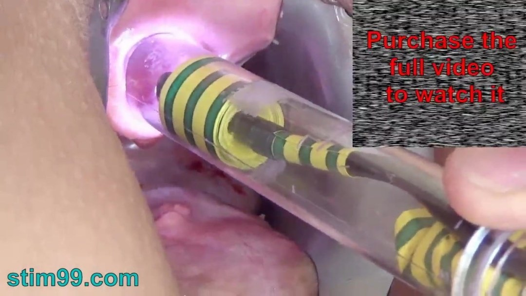 Expandirse en la uretra bdsm