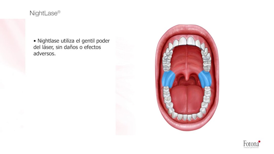 Rezolvati en n Ecuatia 5.6 (X -3) -3.2