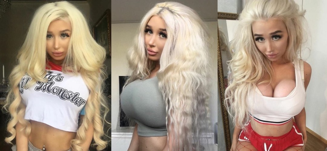 Amanda Kerni antes y después de plástico