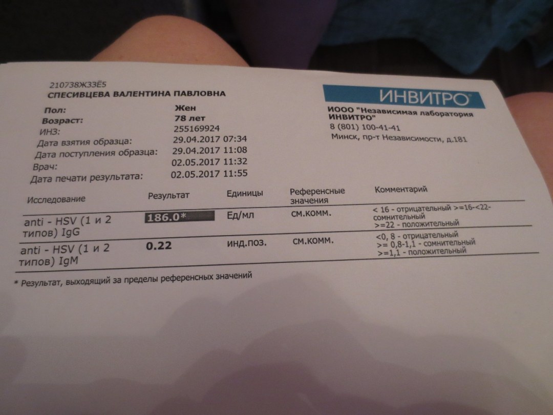 Invitro Anticuerpos contra Coronavirus