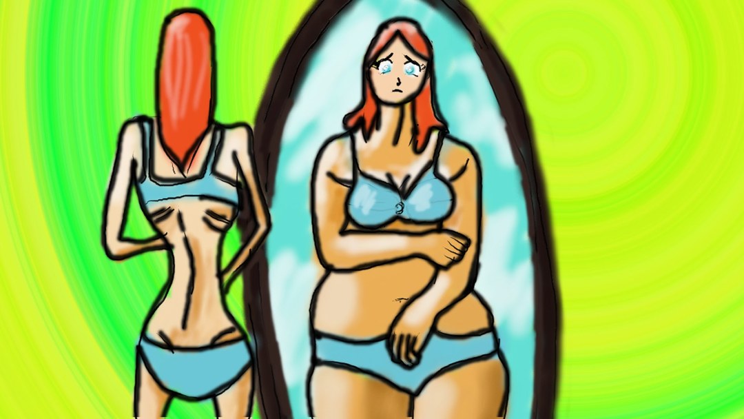 Daria Parkhomenko Anorexia