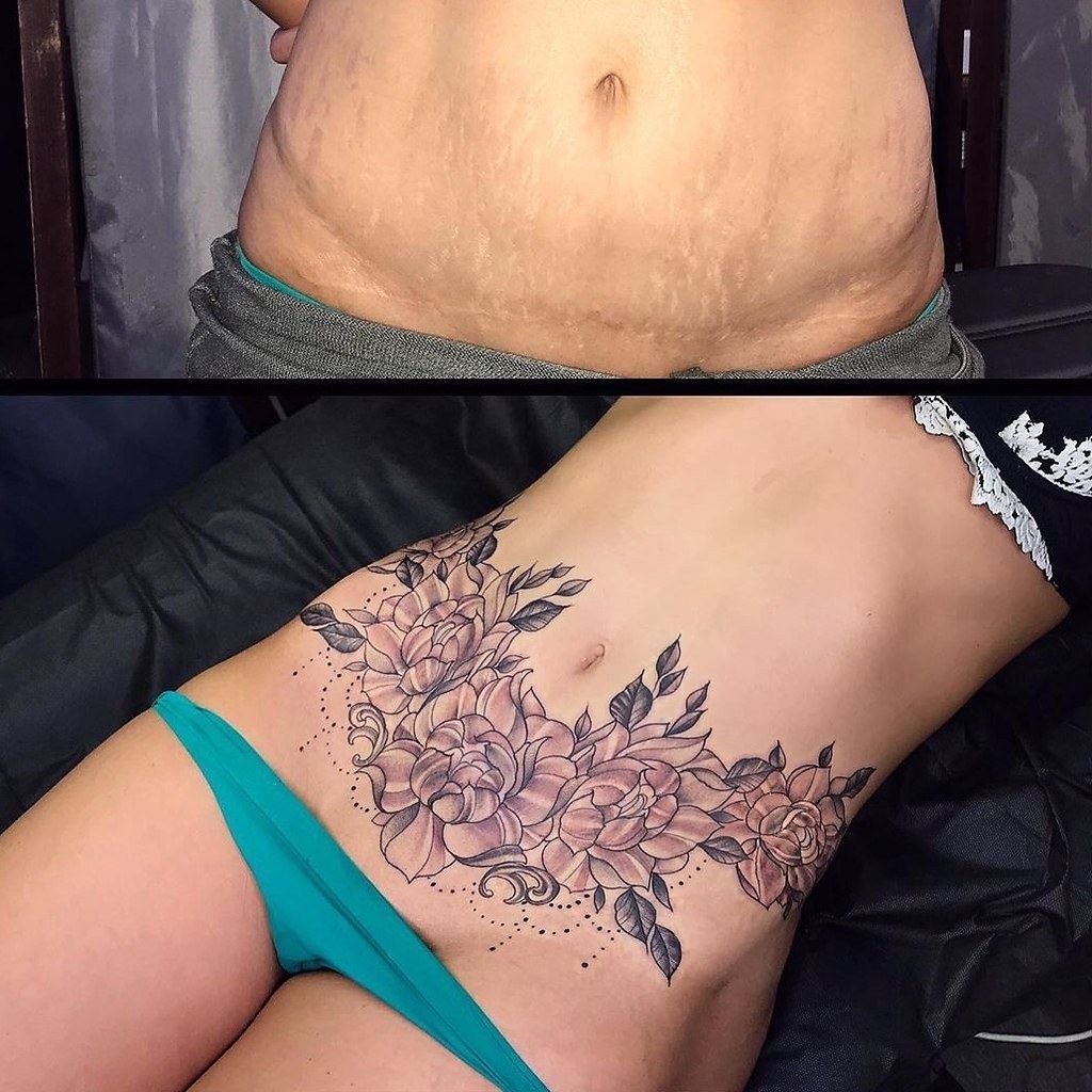 La inscripción en el muslo