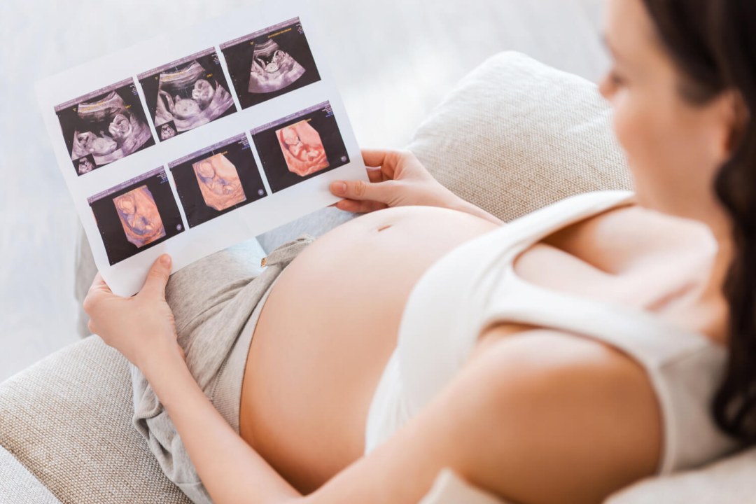 Collage de fotos de mujeres embarazadas