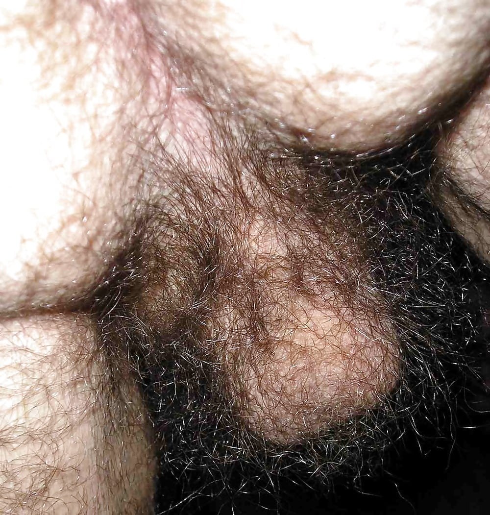Enormes huevos peludos