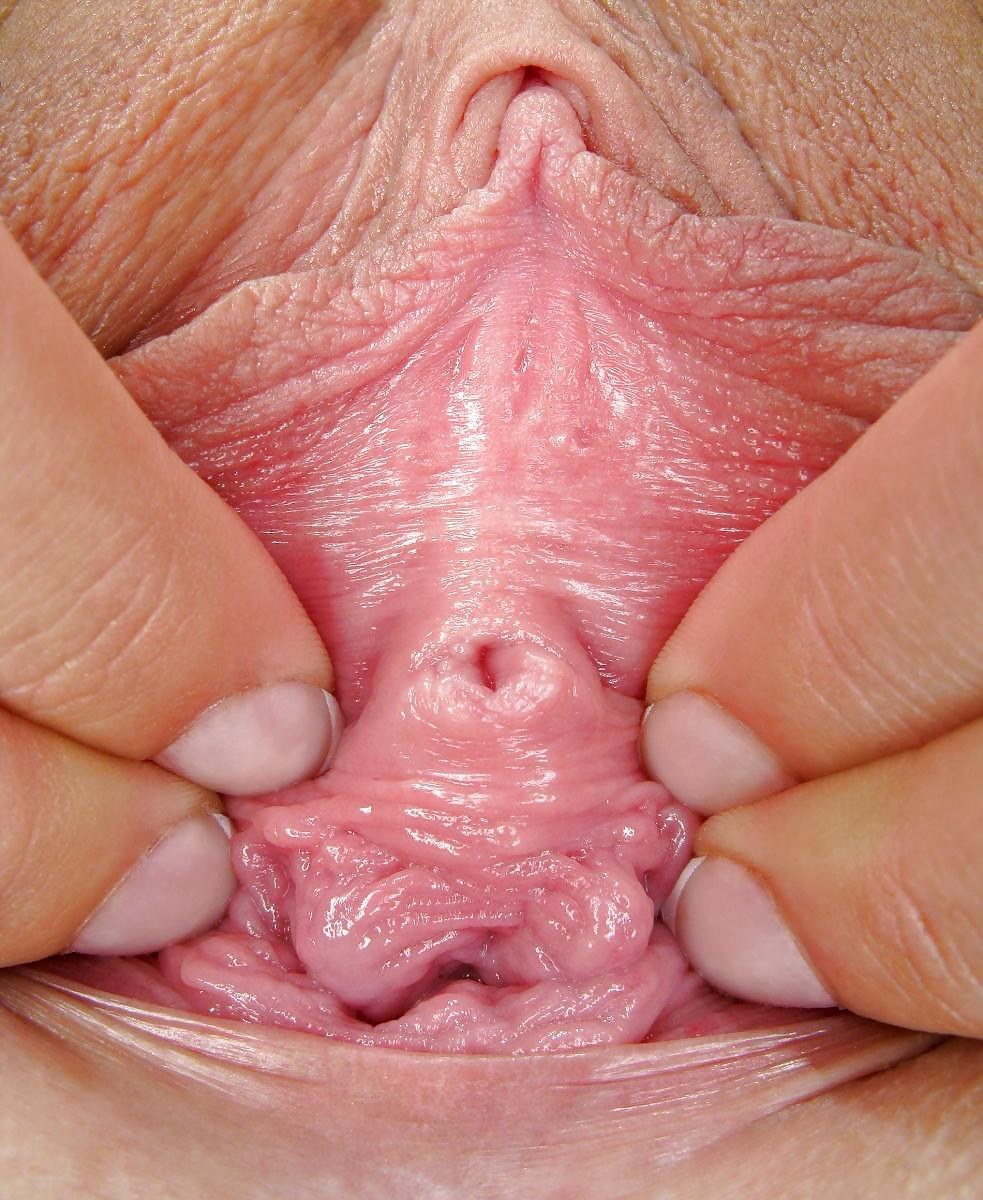 Vagina de una mujer sana