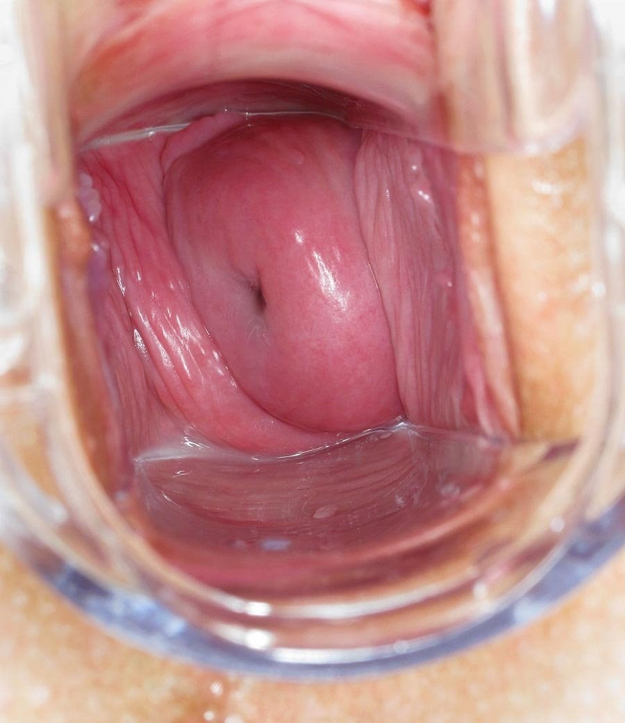 Vagina sana desde el interior
