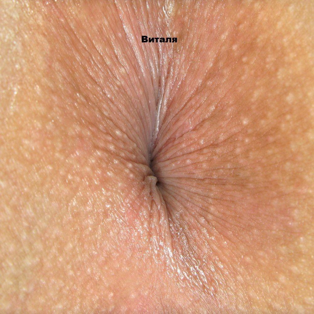 Ano brillante primer plano