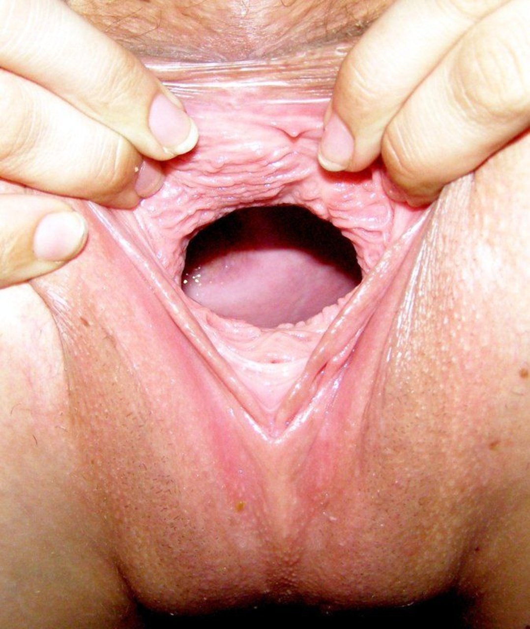 Dentro de la vagina es grande