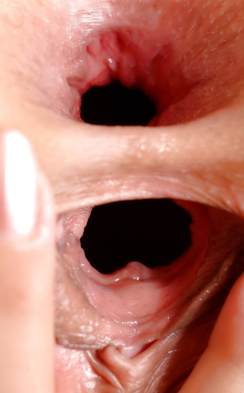 Dentro de la vagina cerrada