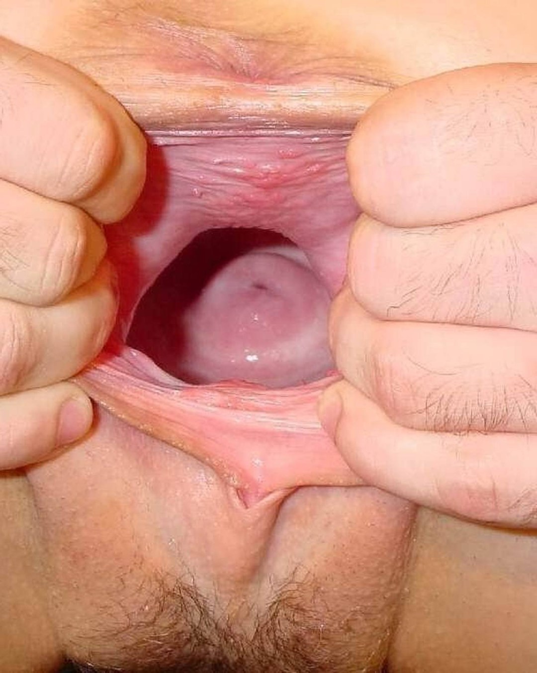 Vagina sana desde el interior