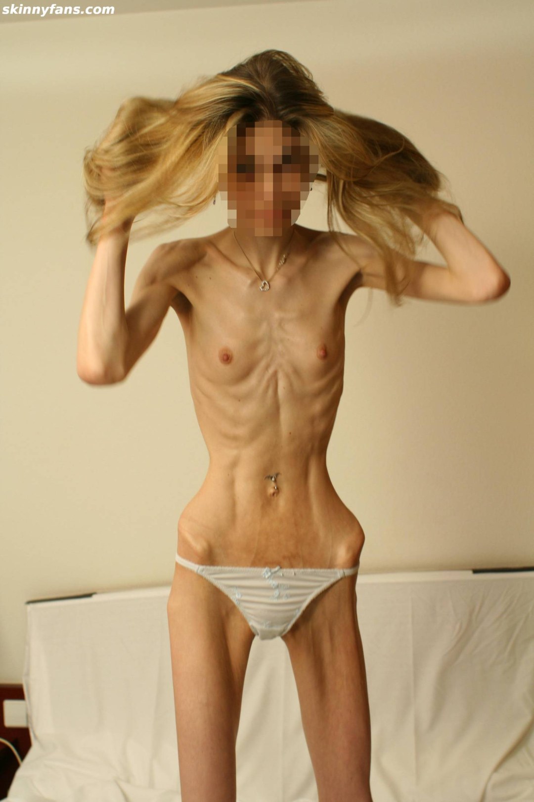 Anorexia. Había una actriz porno