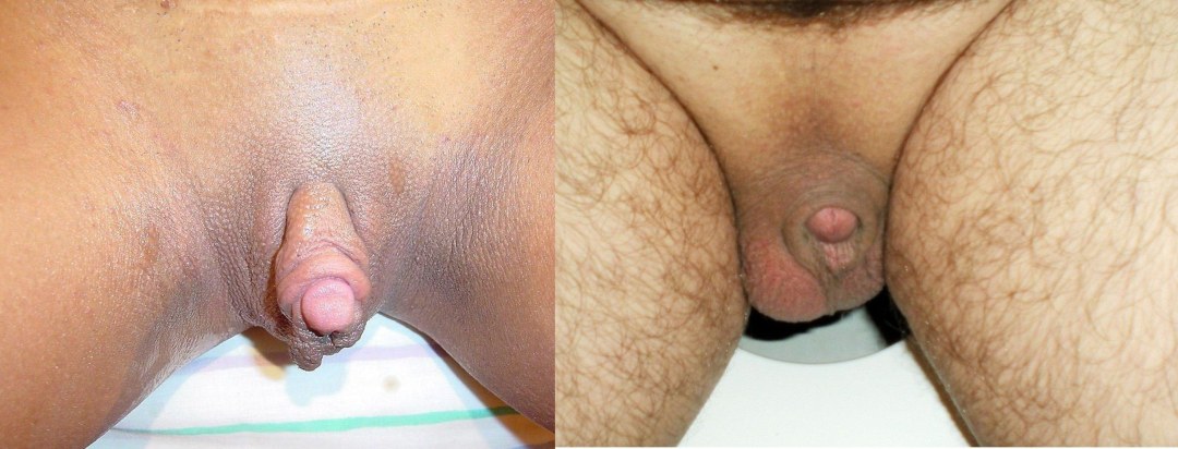 El pisis masculino más pequeño