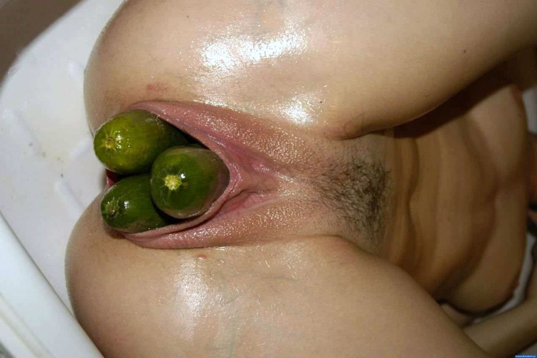 Vagina en forma de hamburguesa