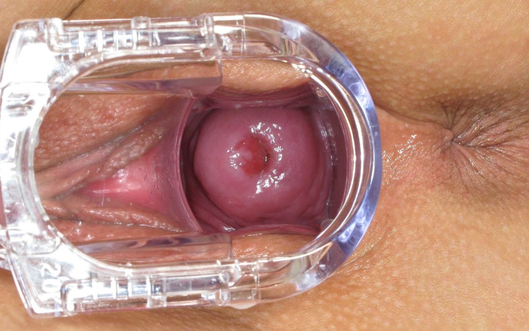 La vagina de una mujer desde adentro