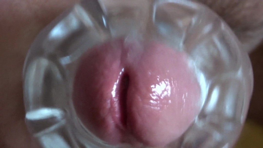 La cámara dentro de la vagina