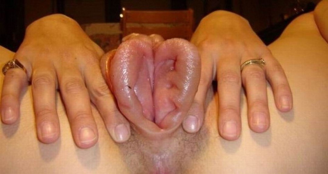 Labios de silicio labios