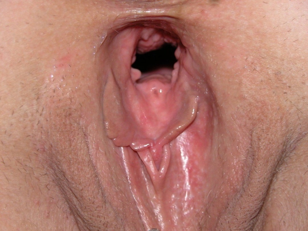 Dentro de la vagina es grande