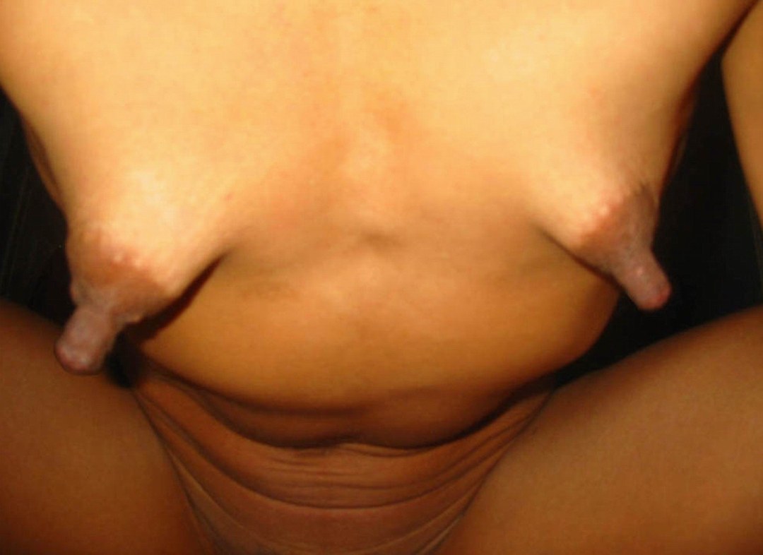 Pequeños pezones largos
