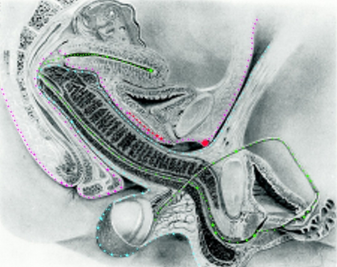 Vagina desde el interior en la sección