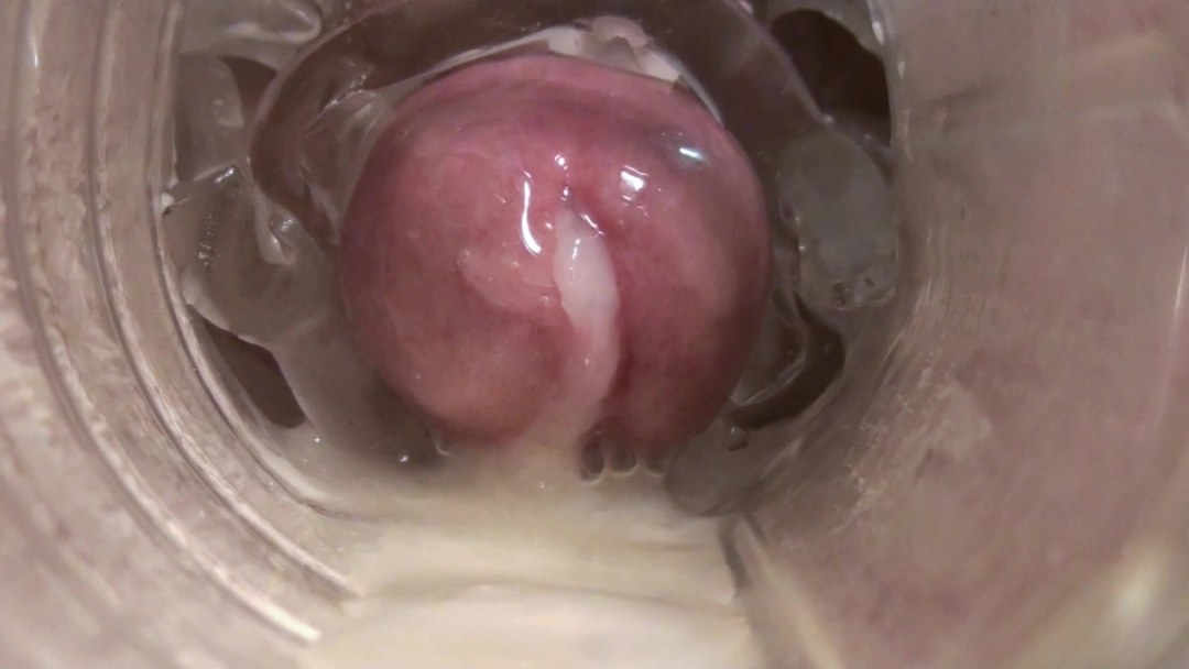 La cámara dentro de la vagina