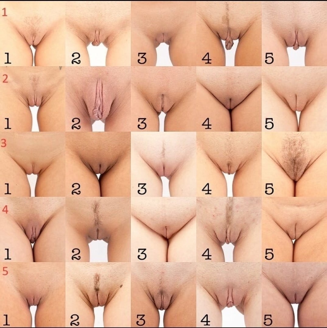 Variedades de la vagina femenina