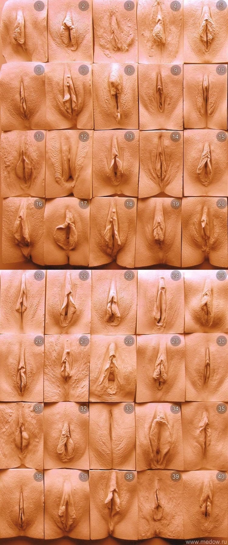 Clasificación de la vagina femenina