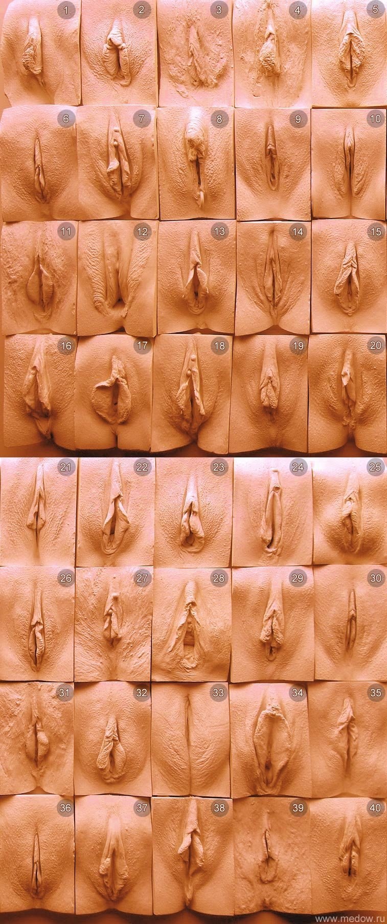 Formas de órganos genitales en mujeres