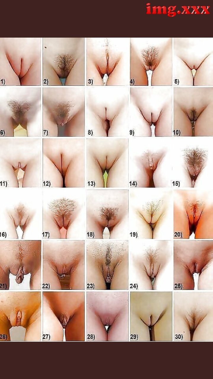 Tipos de ubicación de vagina