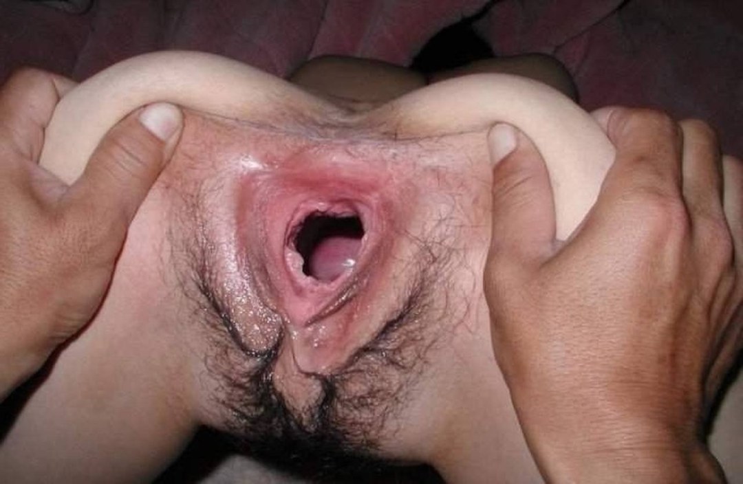 Enormes agujeros de la vagina