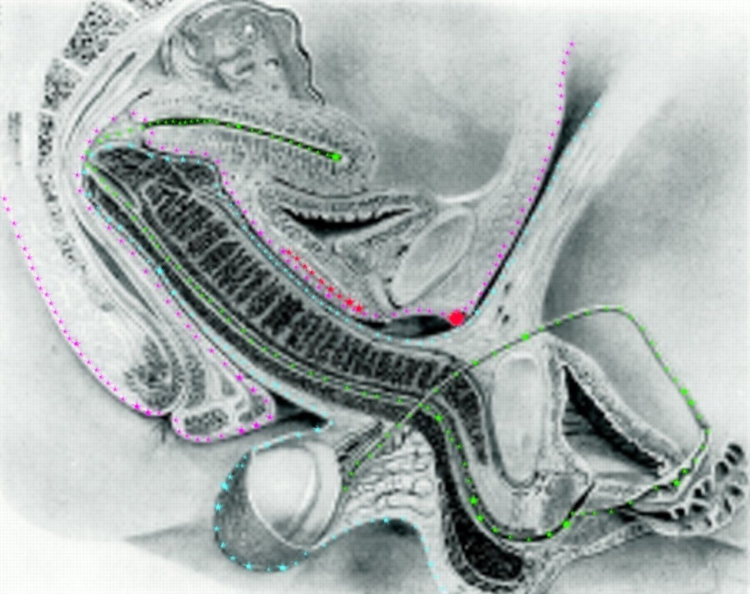 Vagina desde el interior en la sección