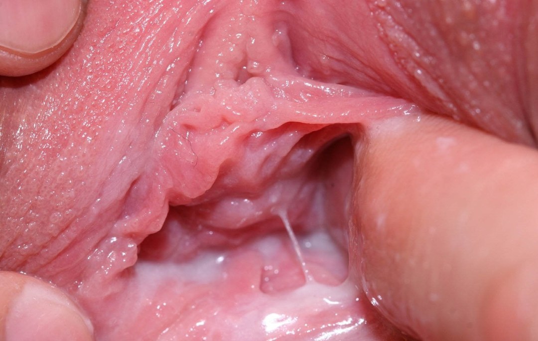 Dentro de la vagina cerrada