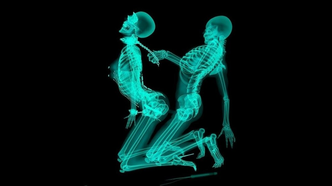Esqueleto x -ray