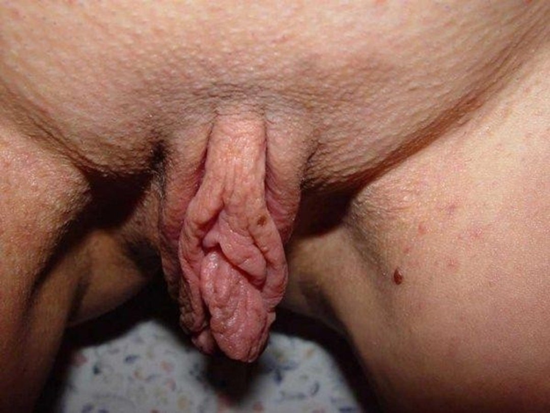 Genitales femeninos feos