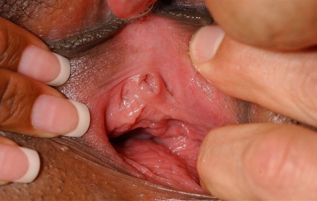 Vagina sana desde el interior