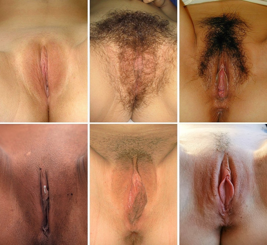 Formas de genitales femeninos