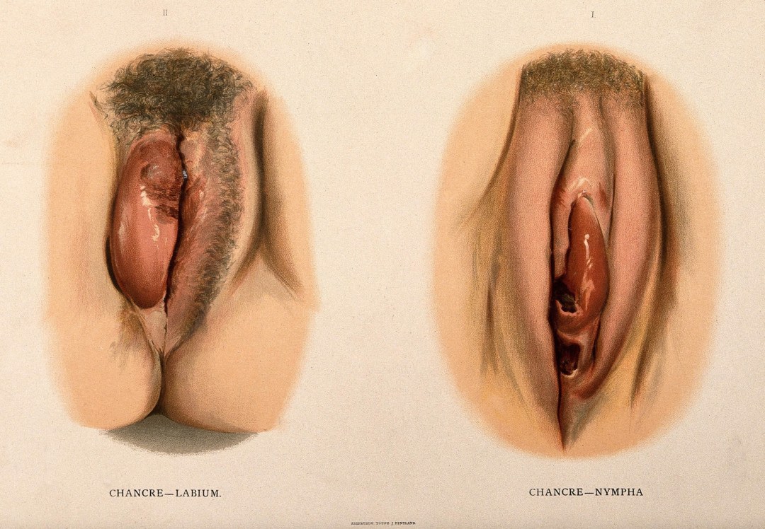 Cara y genitales femeninos