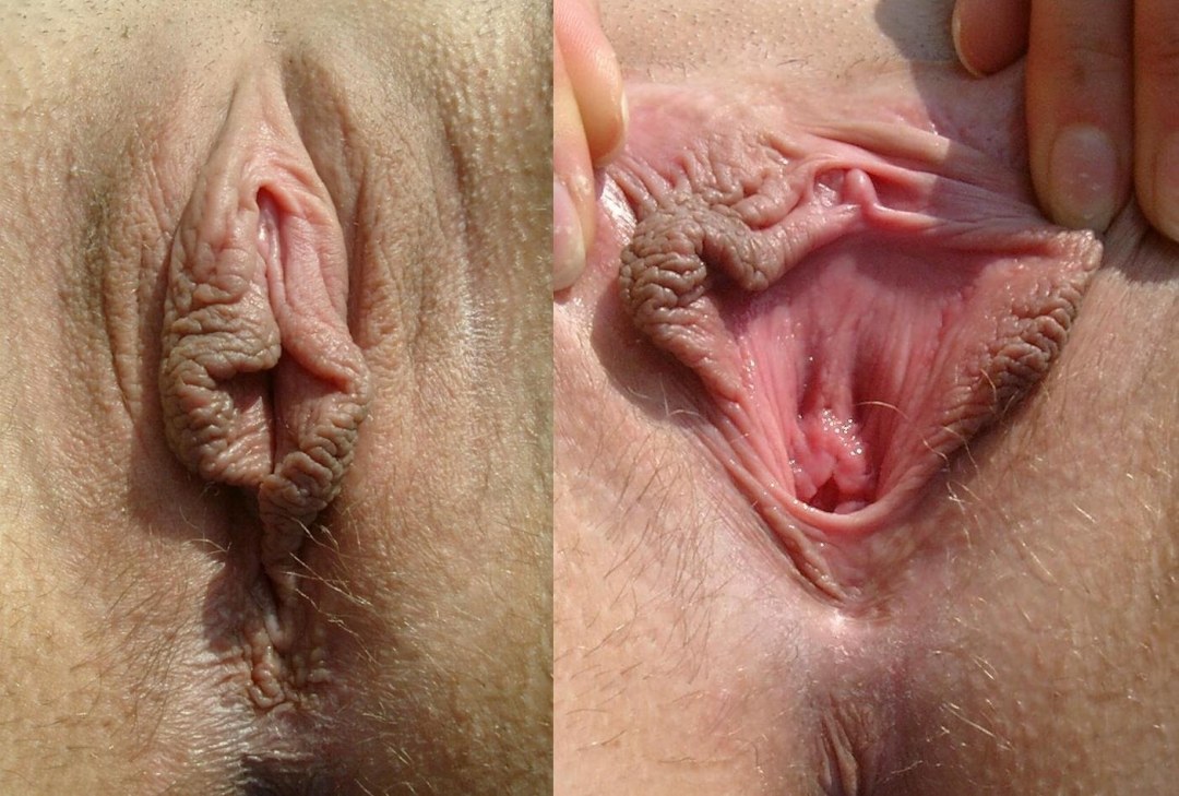 Diferentes edificios de la vagina