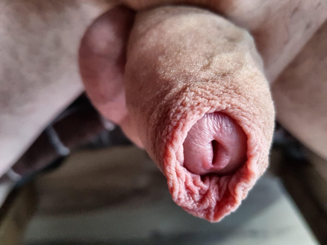 Pequeño pene con prepucio